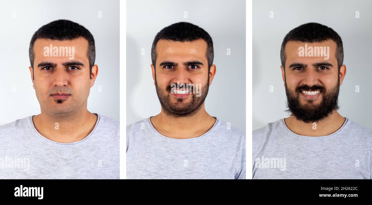Fotocollage eines Mannes mit unterschiedlichen Gesichtshaarstilen auf weißem isoliertem Konzept. Stockfoto
