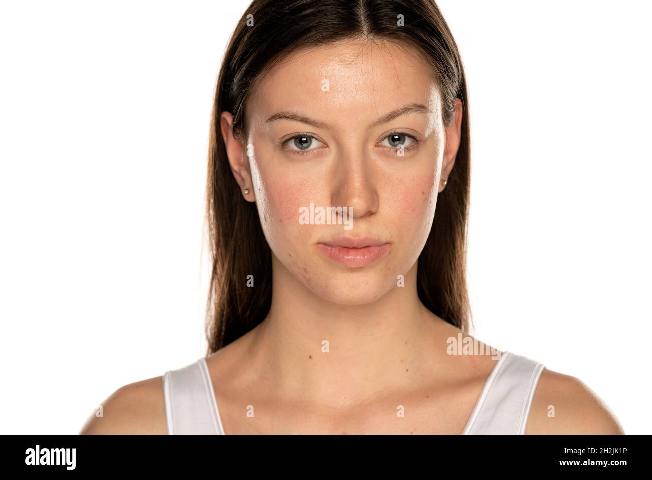 Schöne positive Frau ohne Make-up und problematische Haut auf weißem Hintergrund Stockfoto