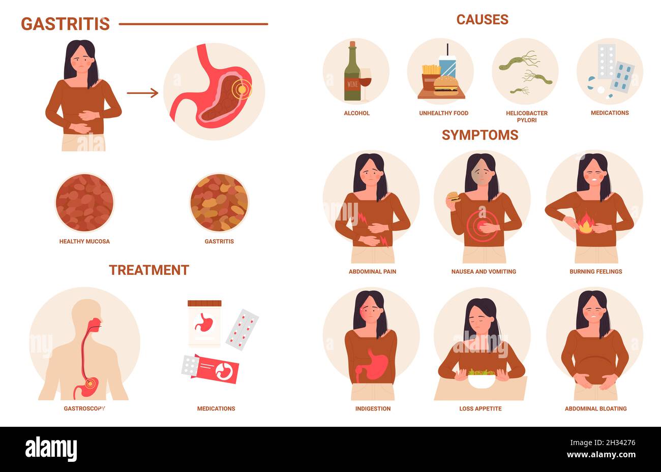 Gastritis, medizinische Infografik Vektordarstellung. Erkrankungen des