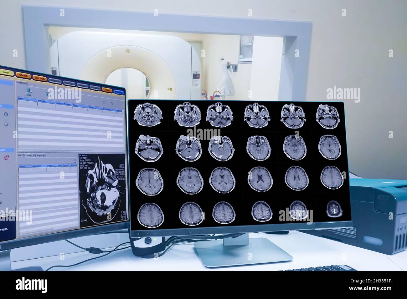 CT Scan Kontrollraum und Computer mit Gehirnscan, Medizintechnikkonzept Stockfoto