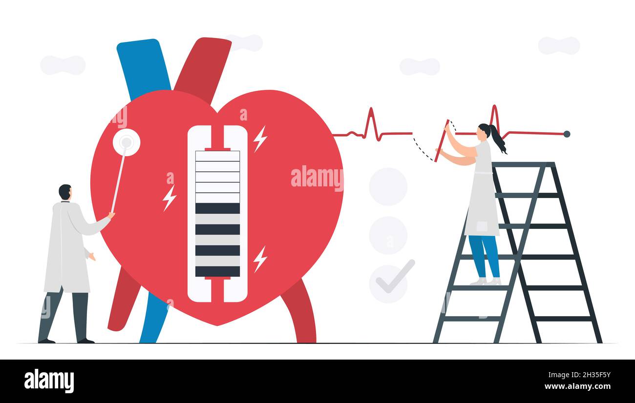 Dieses Herzproblem ist eine Bradykardie-Arrhytie. Diagnose und Analyse zeigen, dass das regelmäßige Signal eine langsame Impulsantwort um den Sinusknoten ist. C Stock Vektor