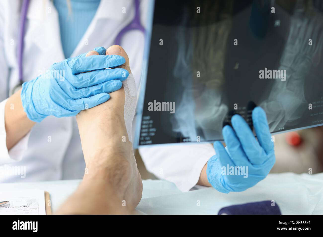 Der Arzt betrachtet die Röntgenaufnahme des Fußes und untersucht die Nahaufnahme des Patienten Stockfoto