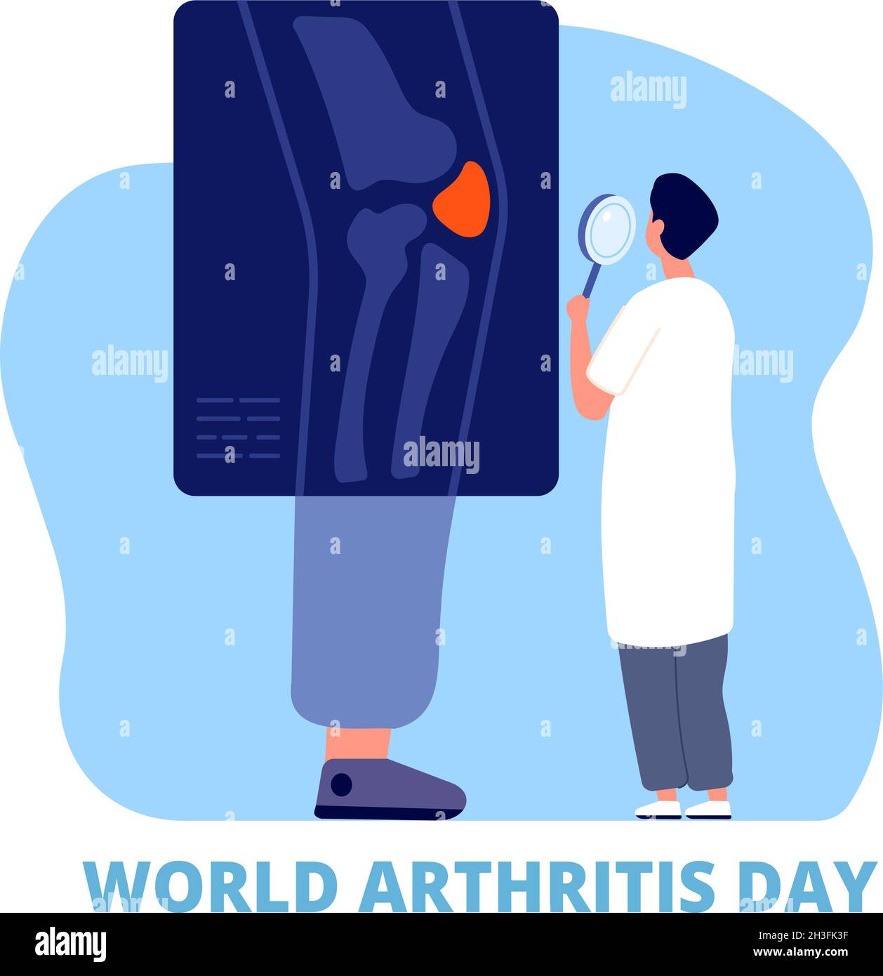 Welt Arthritis Tag. Medizinkonzept, Verteidigungsgelenk, Gesundheit und Pflege. Osteoarthritis, Arzt untersuchen Bein Knie Knochen auf Röntgen-Utter-Vektor-Hintergrund Stock Vektor
