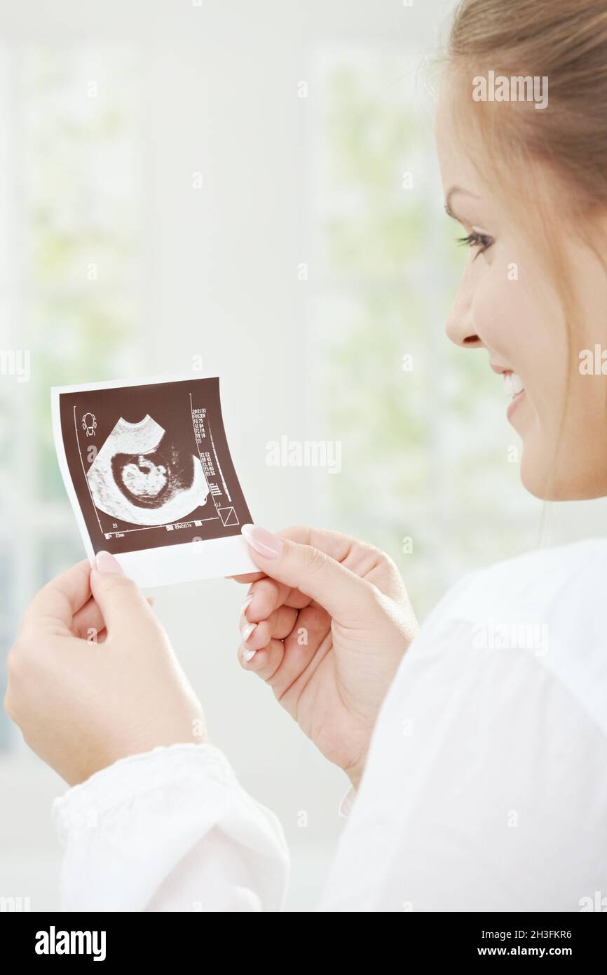 Schwangere Frau Holding Sonogramm Stockfoto