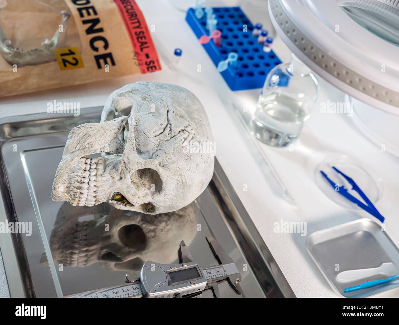 Menschlicher Schädel eines ermordeten Erwachsenen im forensischen Labor, konzeptuelles Bild Stockfoto