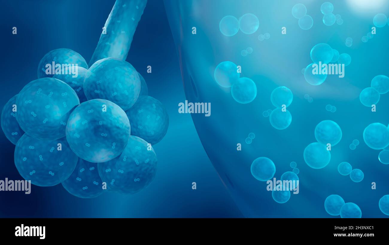 Streptococcus pneumoniae Bakterien in der Lunge Stockfoto