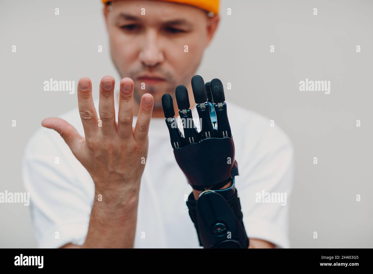 Junger behinderter Mann überprüft und schaut auf künstliche prothetische Hand und vergleichen mit gesunder Hand. Stockfoto