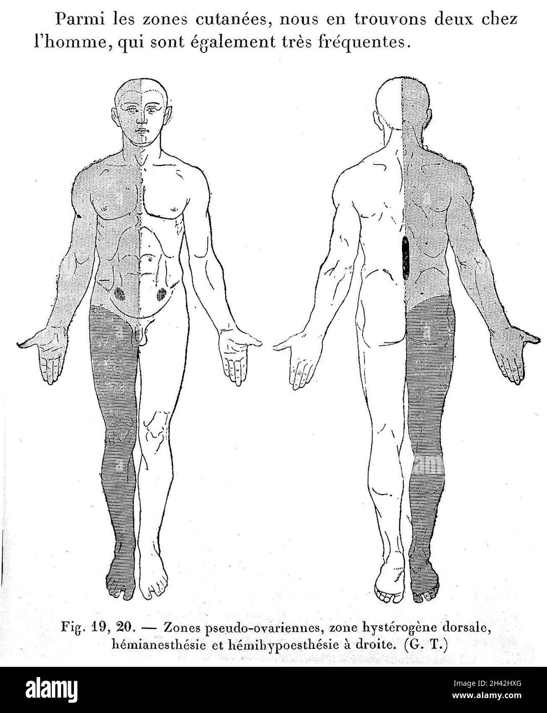 G. Gilles de la Tourette, Traite clinique et therapeutique... Stockfoto
