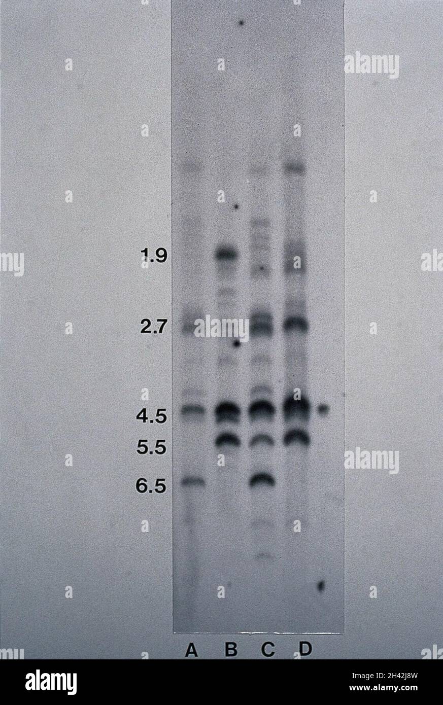 Allergieforschung, Autoradiograph, DNA Stockfoto