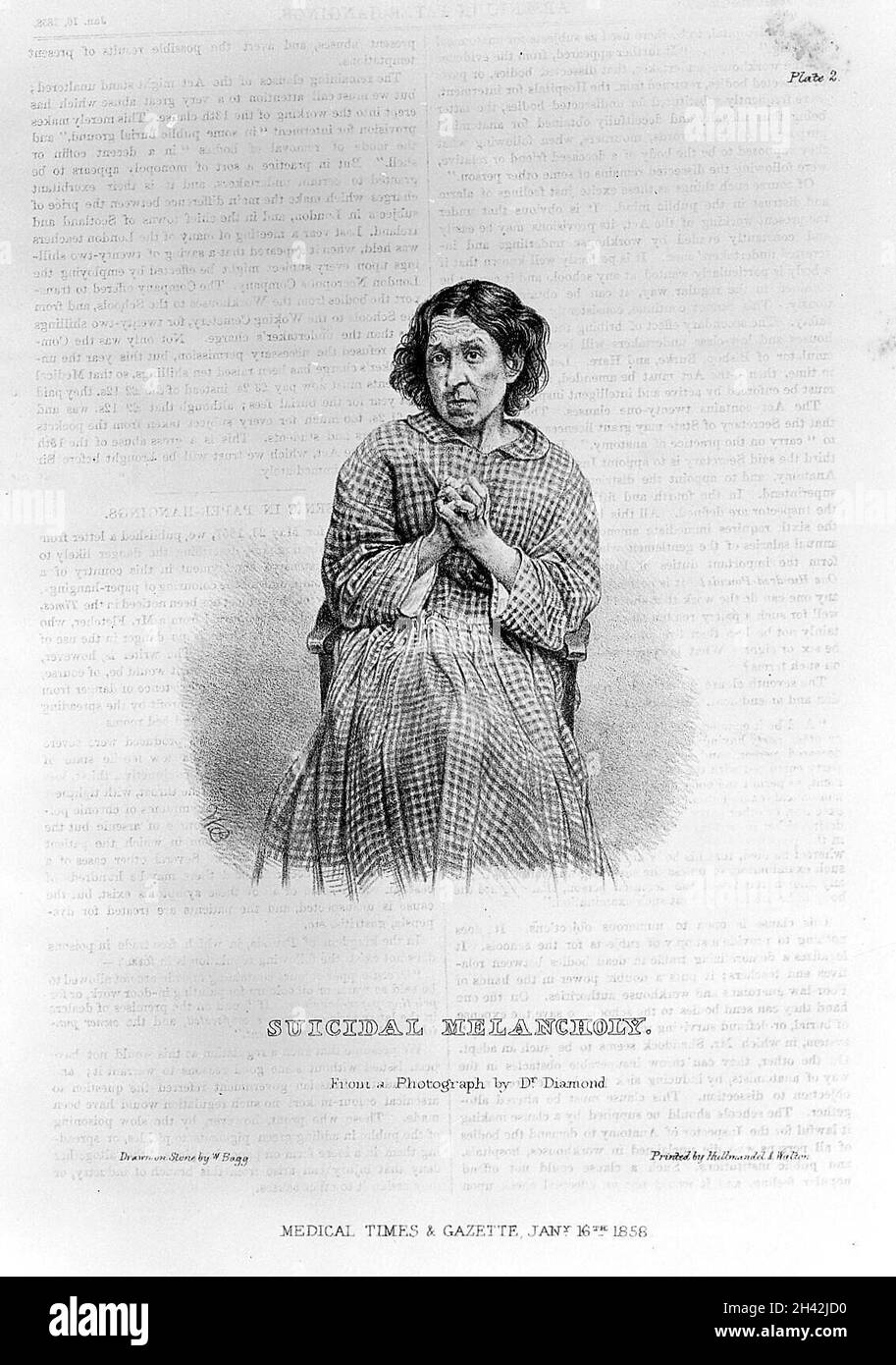 „Selbstmordmelanik“ nach einer Fotografie von H. W. Diamond Stockfoto