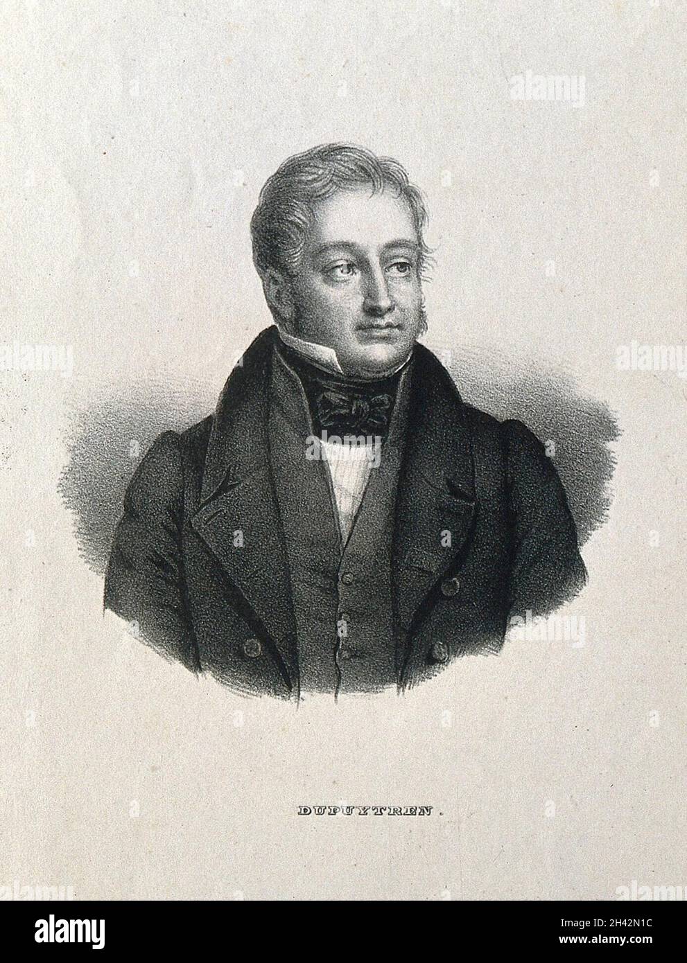 Guillaume, Baron Dupuytren. Lithographie. Stockfoto
