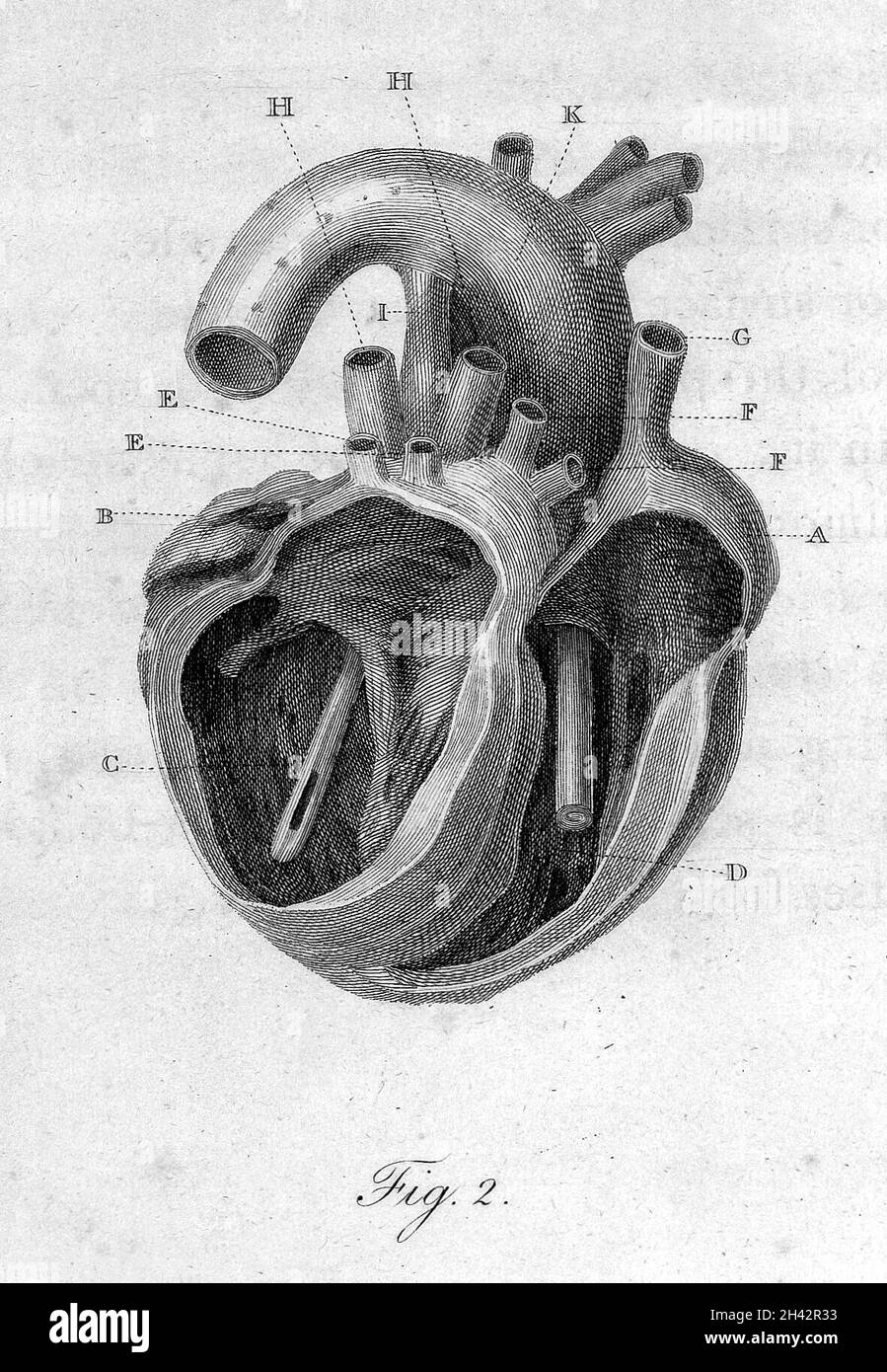 Matthew Baillie, eine Reihe von Stichen. Stockfoto