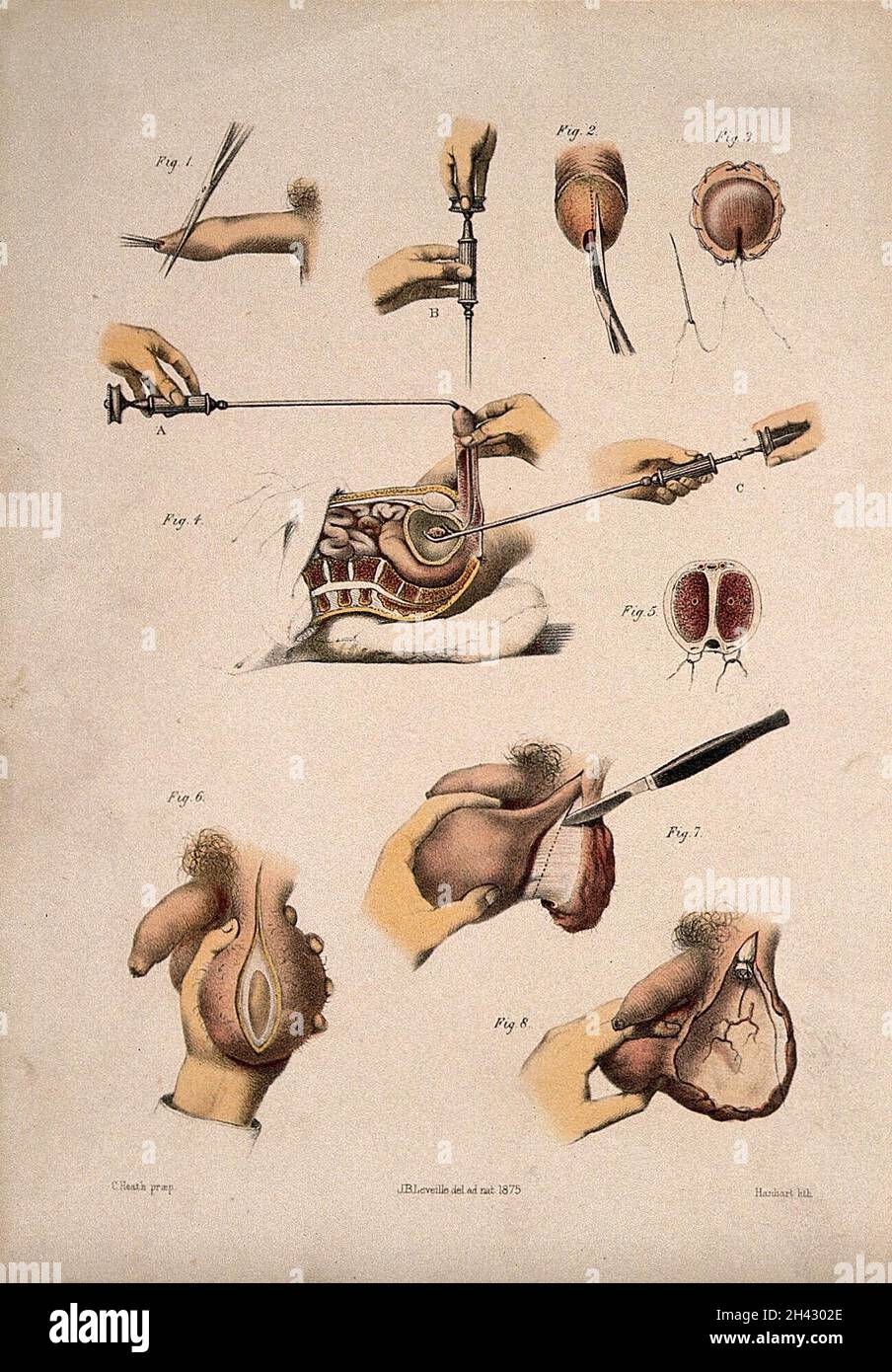 Männliche Fortpflanzungsorgane und Querschnitt durch den Hodensack. Kolorierte Lithographie von M. Hanhart nach C. Heath nach J.B. Léveillé. Stockfoto