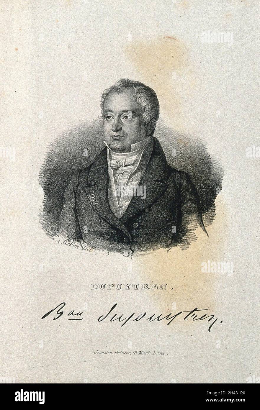 Guillaume, Baron Dupuytren. Lithographie von A. Picken. Stockfoto