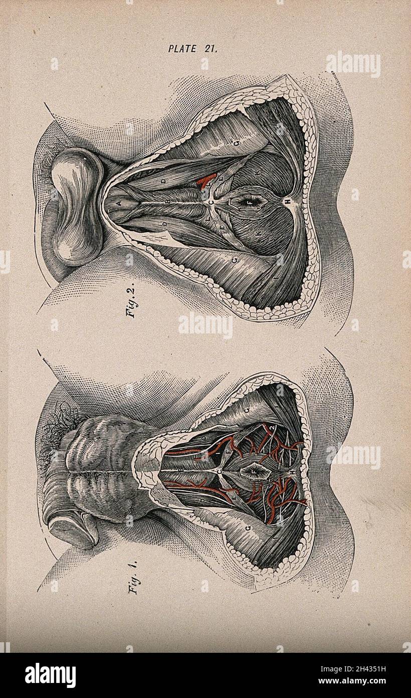 Sektionen des männlichen Genitalbereichs und des rektalen Bereichs: Zwei Figuren. Farbholzstich mit Buchdruck, 1860/1900? Stockfoto Sektionen des männlichen Genitalbereichs und des rektalen Bereichs: Zwei Figuren. Farbholzstich mit Buchdruck, 1860/1900? Stockfoto