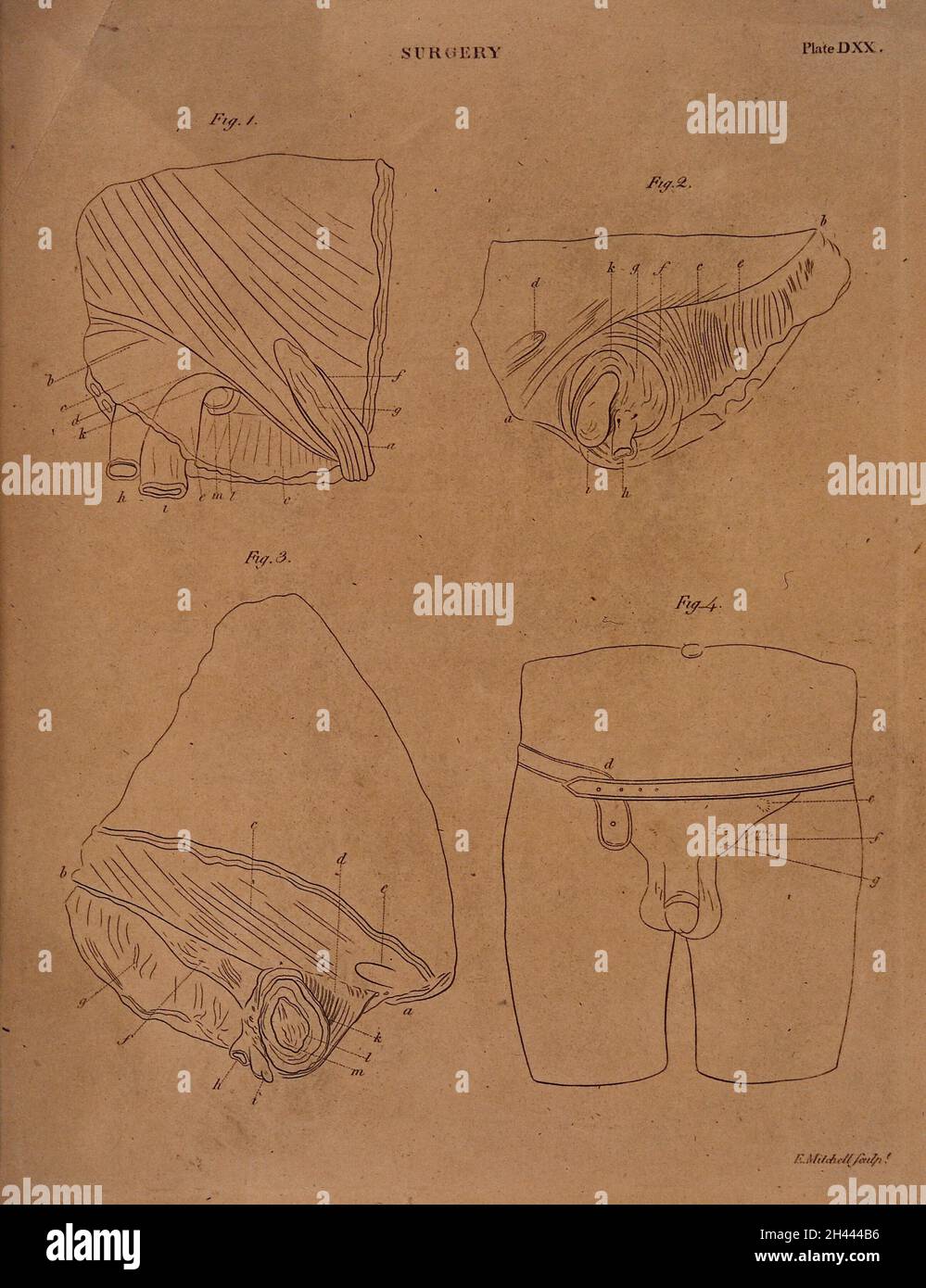 Vier Diagramme, die Querschnitte der männlichen Fortpflanzungsorgane darstellen. Radierung von E. Mitchell. Stockfoto