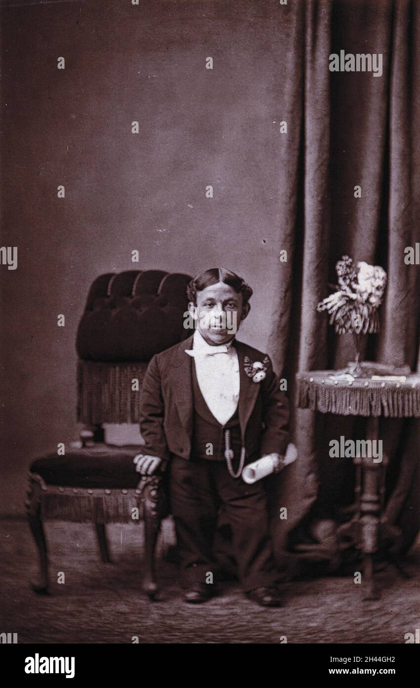 Eine Zwerge (General Milbe?). Foto. Stockfoto