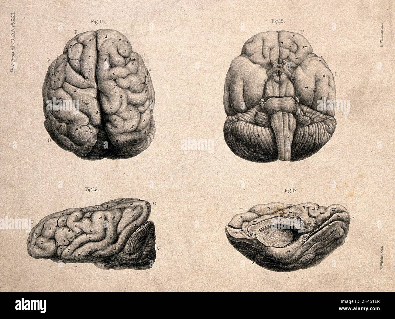Gehirn eines 'europäischen männlichen Idioten' im Alter von 12 Jahren: Vier Figuren. Lithographie von E.M. Williams nach H. Watkins, 1864. Stockfoto Gehirn eines 'europäischen männlichen Idioten' im Alter von 12 Jahren: Vier Figuren. Lithographie von E.M. Williams nach H. Watkins, 1864. Stockfoto