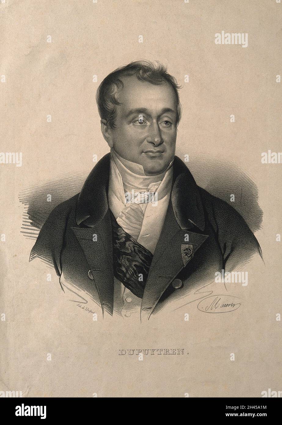 Guillaume, Baron Dupuytren. Lithographie von N. E. Maurin. Stockfoto