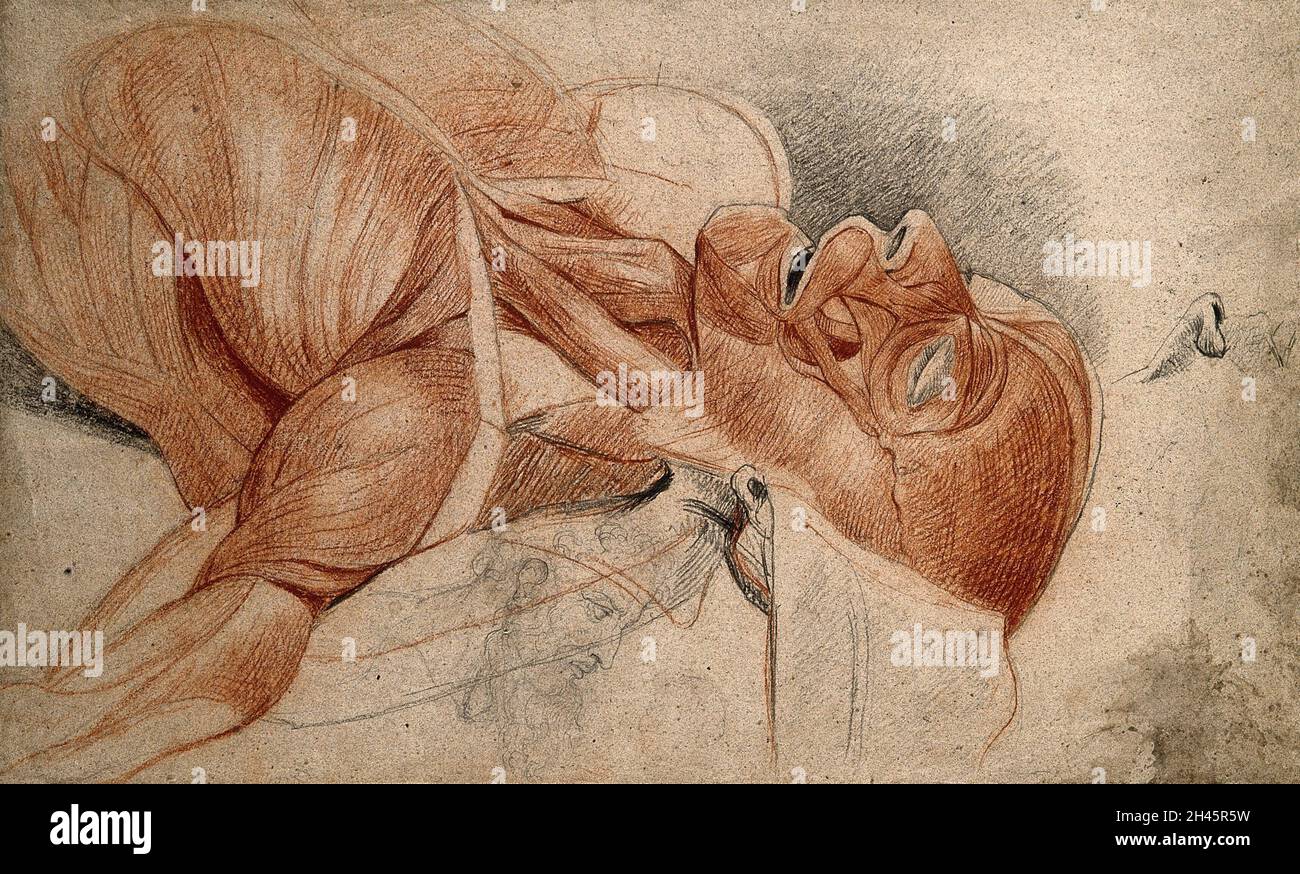 Kopf und Schultern eines écorché-Kadavers, mit kleineren Skizzen einer Nase und eines bärtigen Mannes. Rot-schwarze Kreidezeichnung, mit Bleistift, von C. Landseer, ca. 1815. Stockfoto