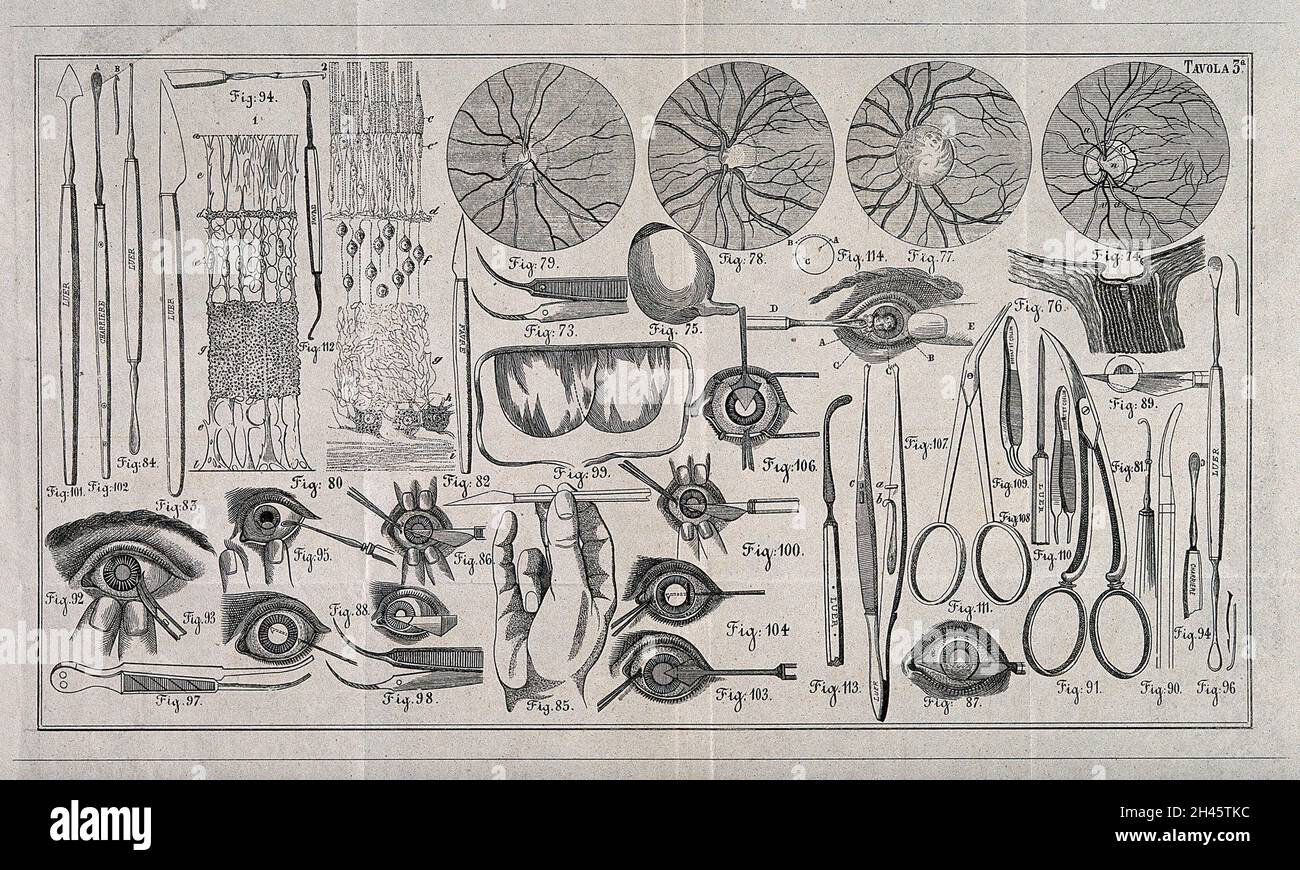 Ein Blatt mit optischen Instrumenten, Augenuntersuchungen und anatomischen Diagrammen des Auges mit einem nummerierten Schlüssel. Holzstich. Stockfoto