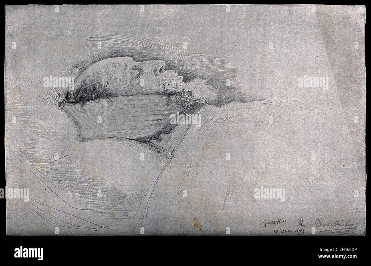 Charles Dickens auf seinem Sterbebett. Halbton, 1870. Stockfoto