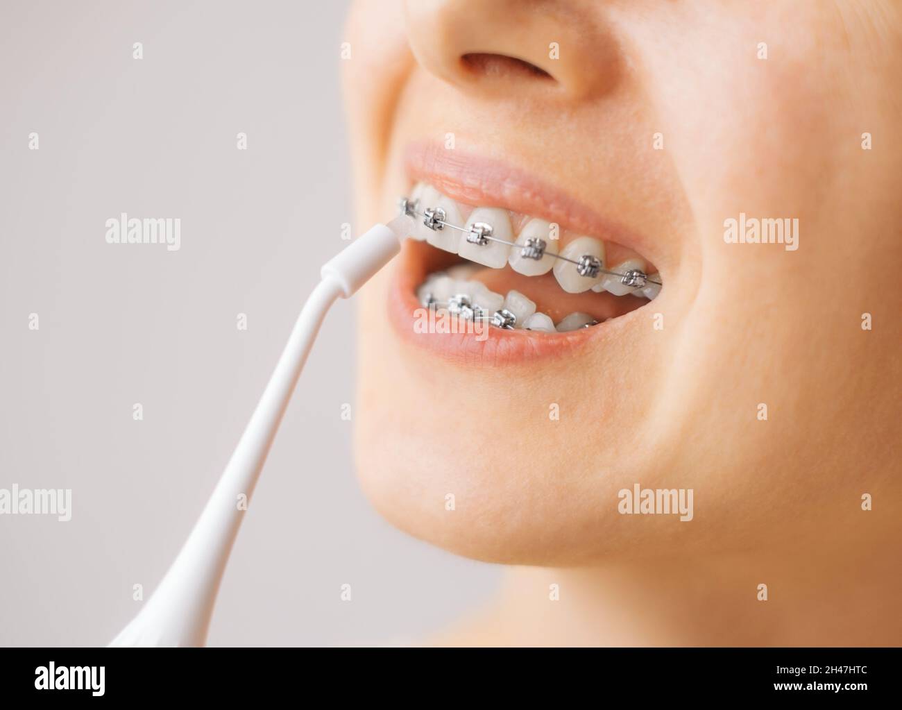 Lächelnde junge, unkenntlich gebliebene Frau mit Zahnspangen, die ihre  Zähne mit einer Munddusche putzen Stockfotografie - Alamy