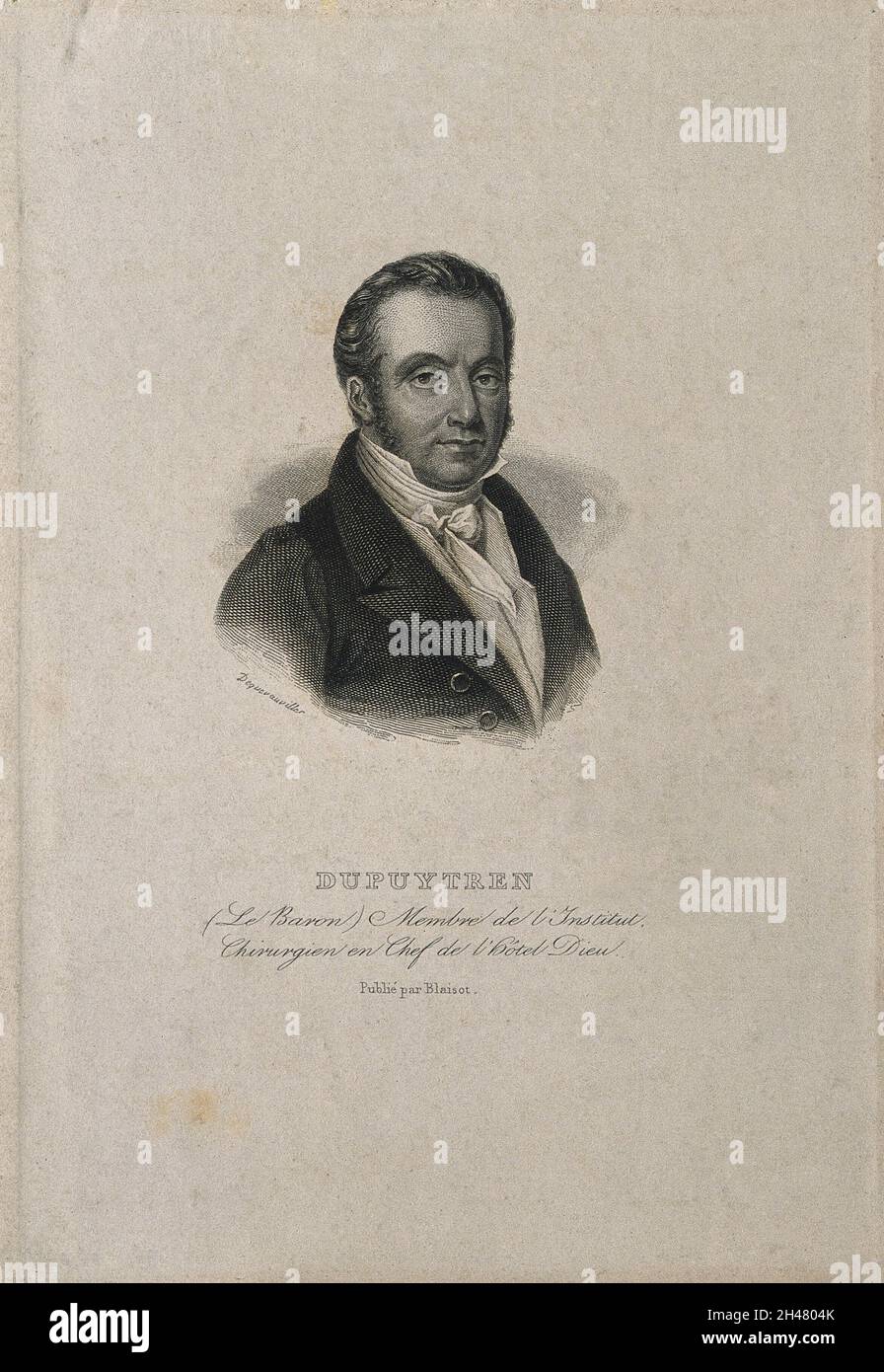 Guillaume, Baron Dupuytren. Linienstich von F. J. Dequevauviller. Stockfoto