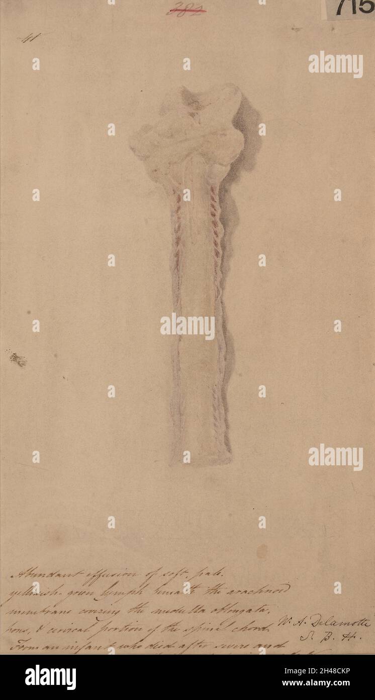 Lymphfluss unter der Arachnoidmembran, die die pons, Medulla oblongata und das Rückenmark bedeckt Stockfoto