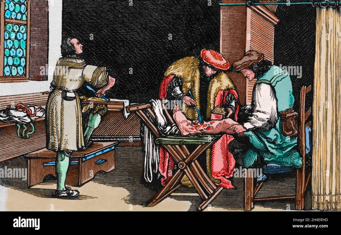 Medizin. Ein deutscher Chirurg. Kopierstich von Hans Holbein, deutsch aus Trost der Philosophie, 16. Jahrhundert. Stockfoto