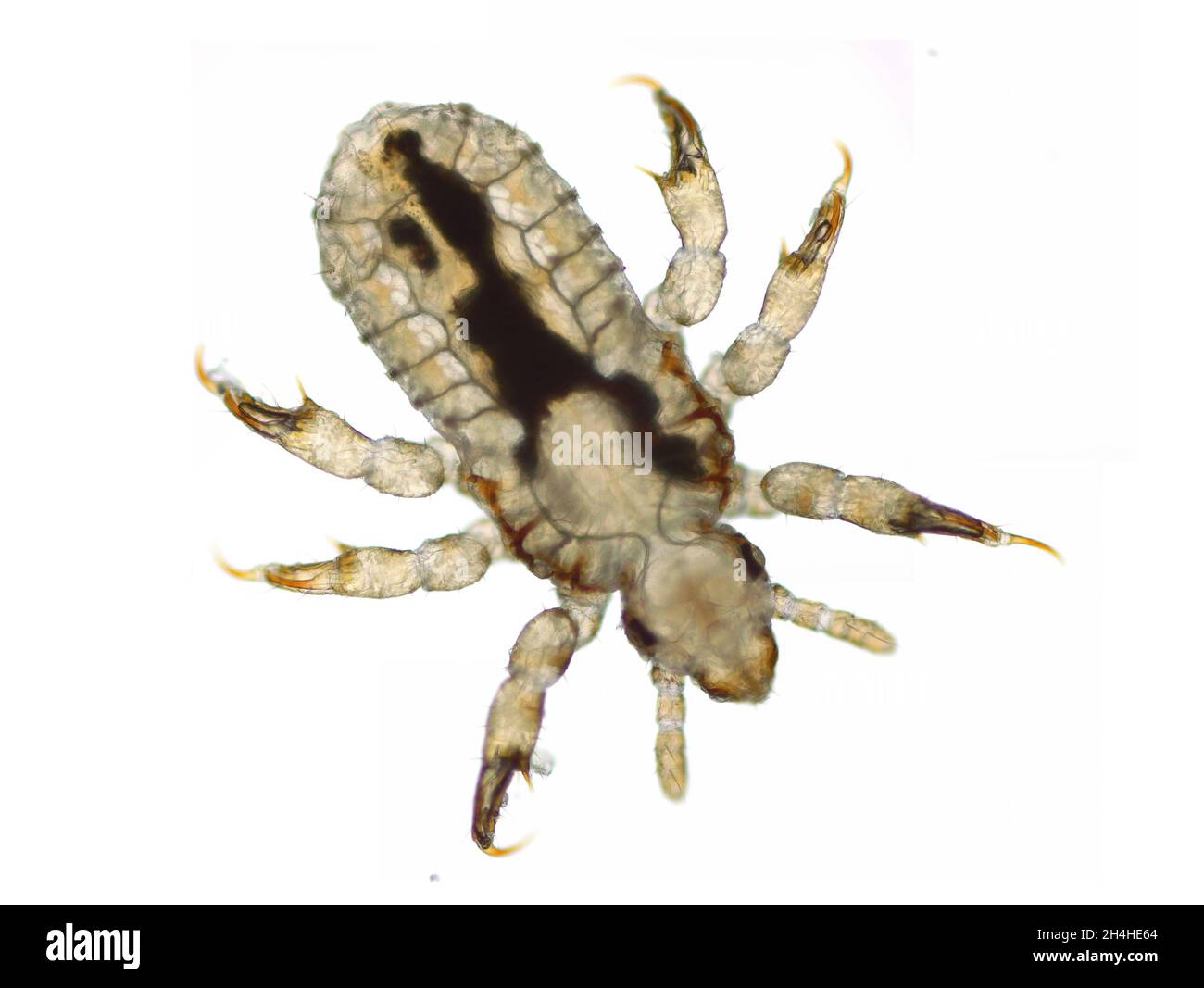 Larvenstadion der menschlichen Kopflaus (Pediculus humanus capitis