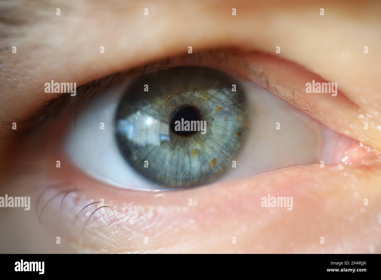 Nahaufnahme des menschlichen Auges, extreme Makroaufnahme des Sehens von Personen, Kapillaren Wimpern und Unvollkommenheiten, verängstigter Blick. Augenheilkunde, Medizin, alternde Chan Stockfoto
