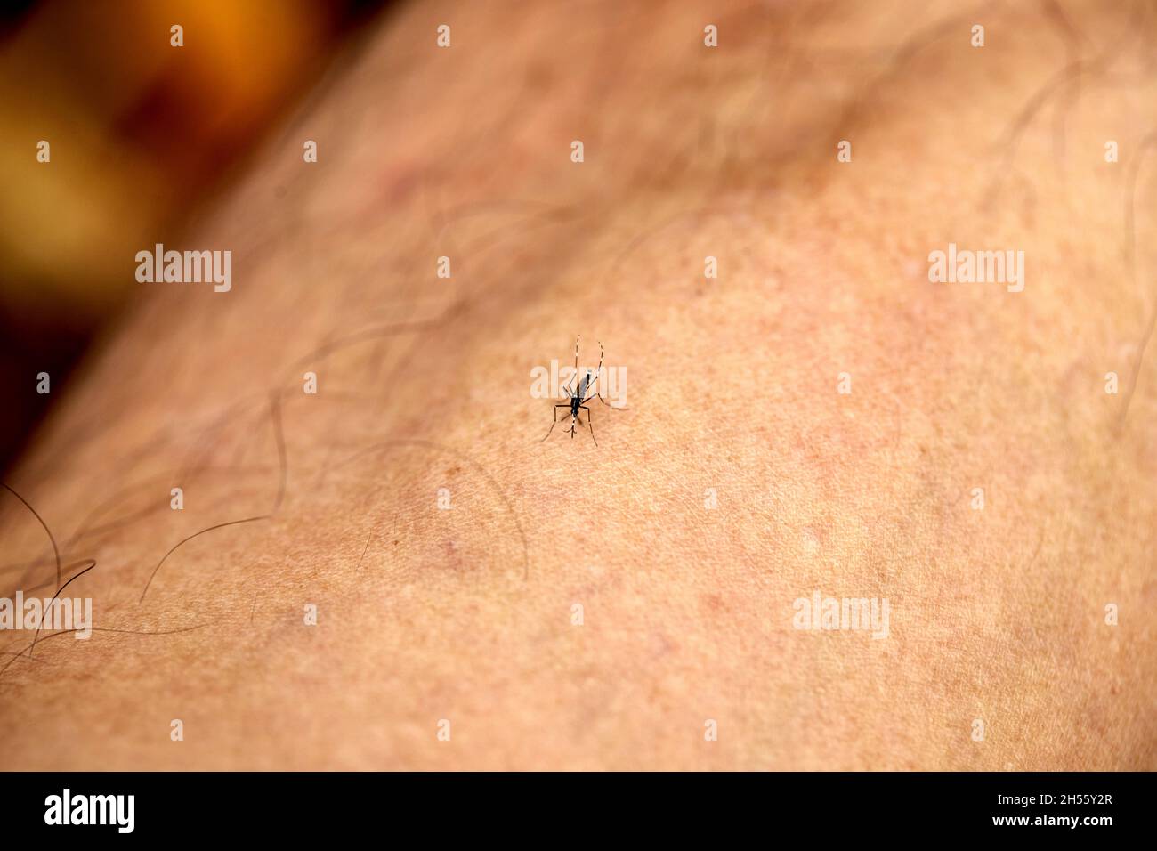 Nahaufnahme einer Mücke, die Blut von der Haut saugt Stockfoto