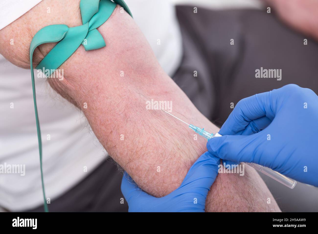 Injektion eines Katheters in den Arm eines Patienten Stockfoto