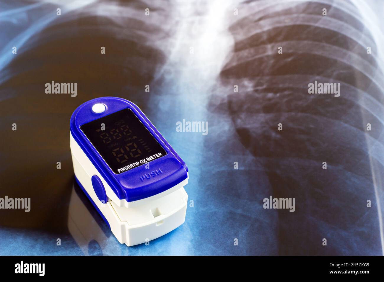 Medizinisches Pulsoximeter mit Fingerspitzen zur Überprüfung der Sauerstoffsättigung bei kovidem Virusentfall. SpO2-Überwachungs- und Herzfrequenzmessgerät wi Stockfoto