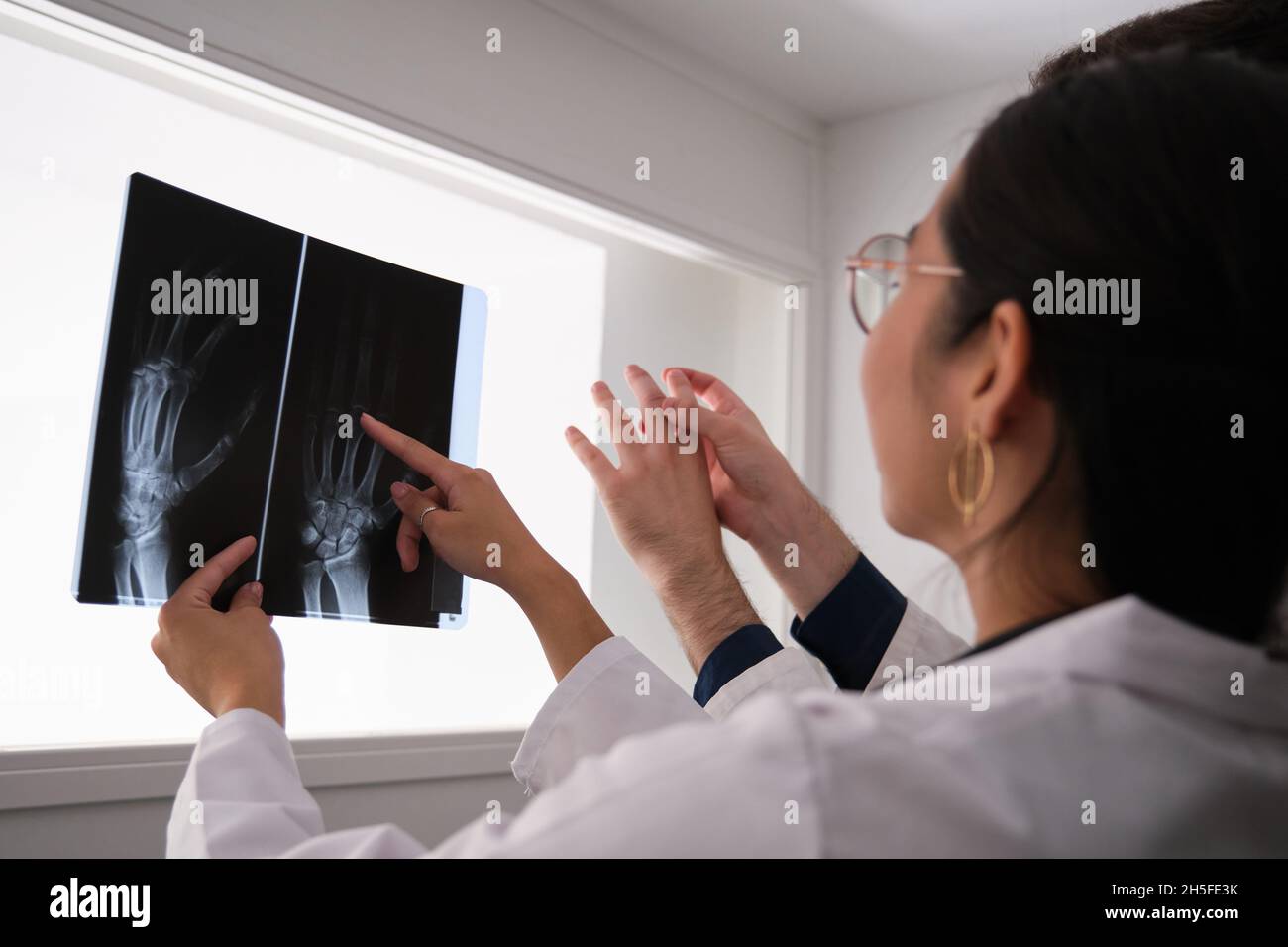 Zwei Ärzte untersuchen das Röntgenbild der Hand. Rheumatoide Arthritis. Stockfoto