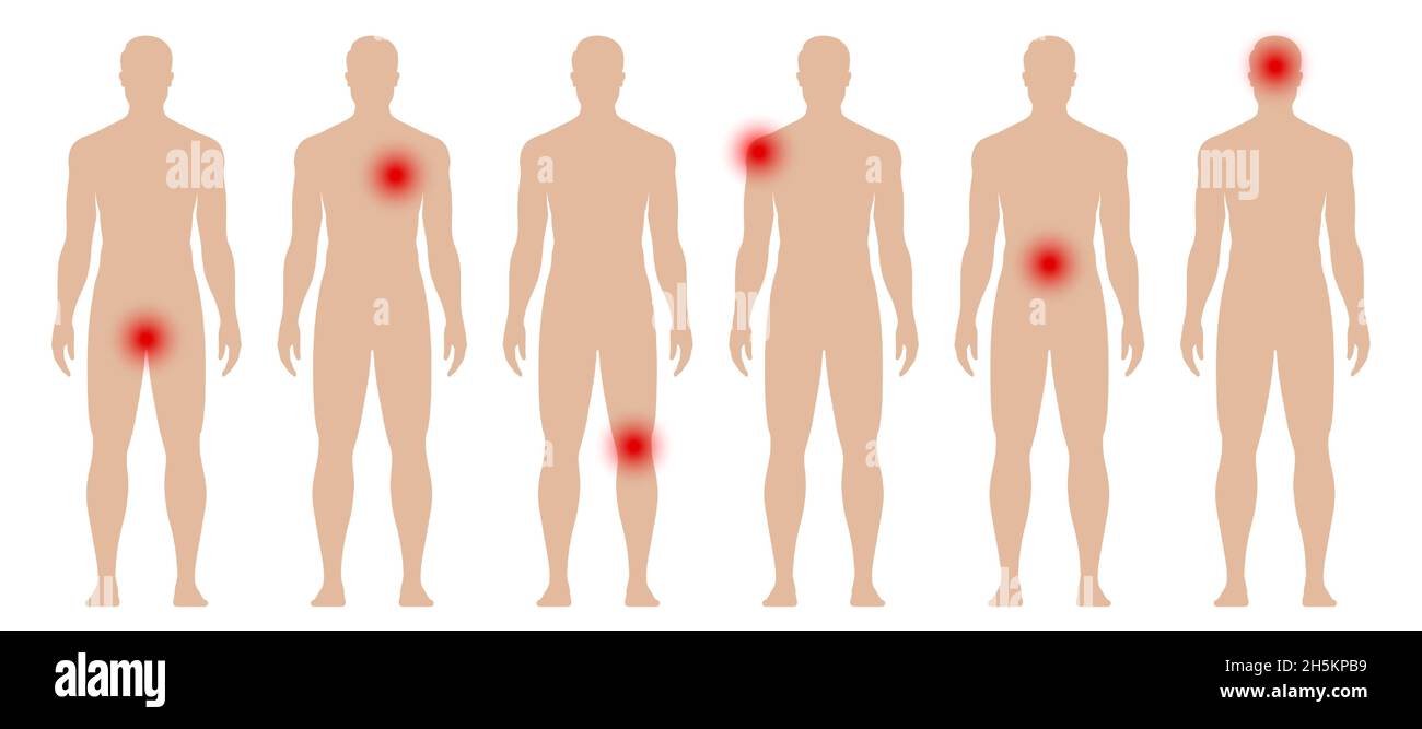 Mann Silhouette mit roten Punkten in verschiedenen Körperteilen. Medizinische Vektordarstellung: Schmerzen und Schmerzen. Stock Vektor