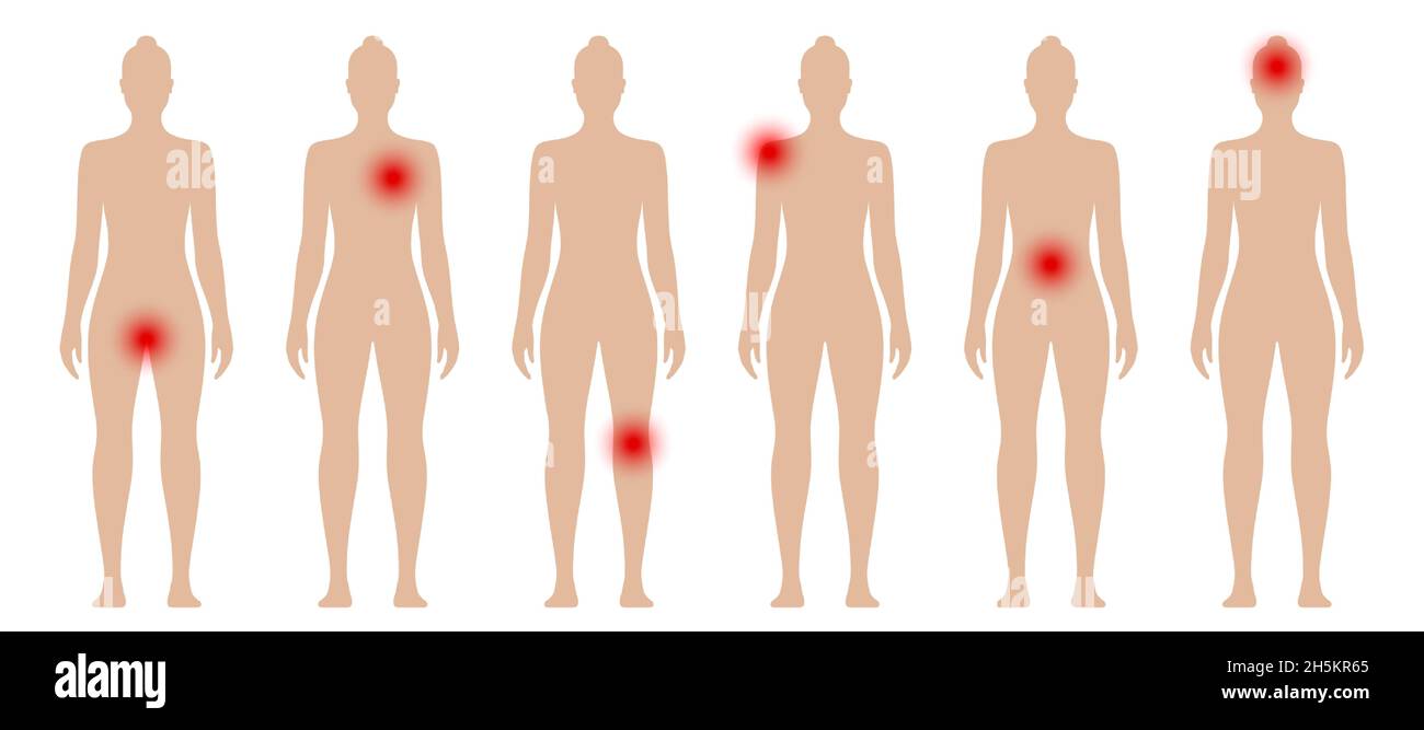 Frau Silhouette mit roten Punkten in verschiedenen Körperteilen. Vektor-Illustration für weibliche Schmerzen und Schmerzen. Stock Vektor