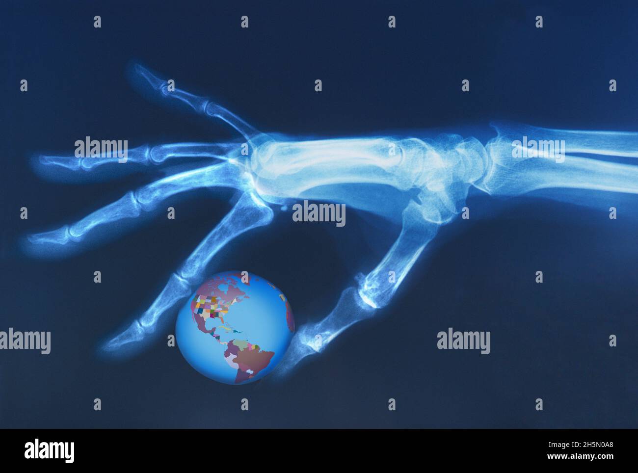 Klimawandel Erde. Röntgenbild menschliches Skelett, das die Weltkugel hält. Ein Mann zerstört den Planeten medizinisches Röntgenbild. Globale Zerstörung, Krieg, Erwärmung der Erde. Stockfoto