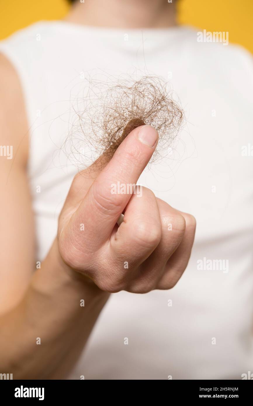 Haarausfall. Die weibliche Hand hält ein Haarsträhnen. Nahaufnahme. Stockfoto