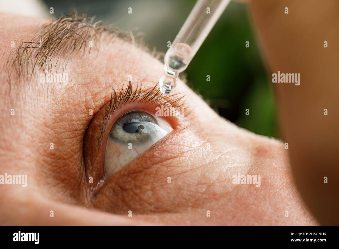 Ein Mann befeuchtet seine Augen, bevor er Kontaktlinsen einführt. Tropfen in den Augen durch Reizungen, Rötungen und Allergien. Stockfoto