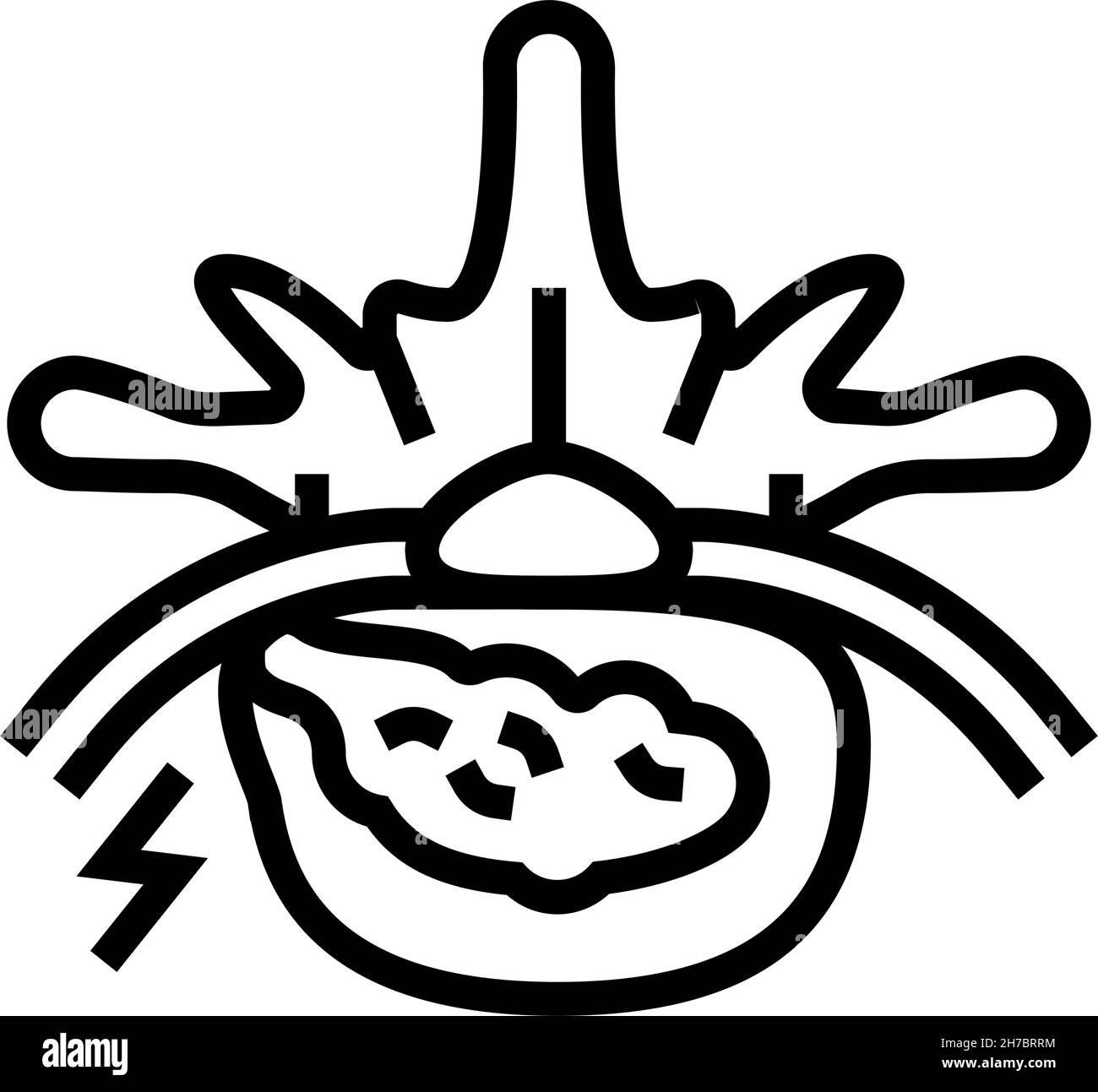 Disektomie Patienten Krankheit Linie Symbol Vektor Illustration Stock