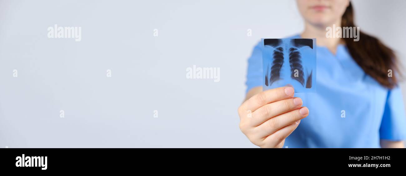 Ein Arzt in blauer Uniform zeigt ein Bild eines Fluorogramms der Fluorographie, einer Röntgenaufnahme der Lunge. Stockfoto