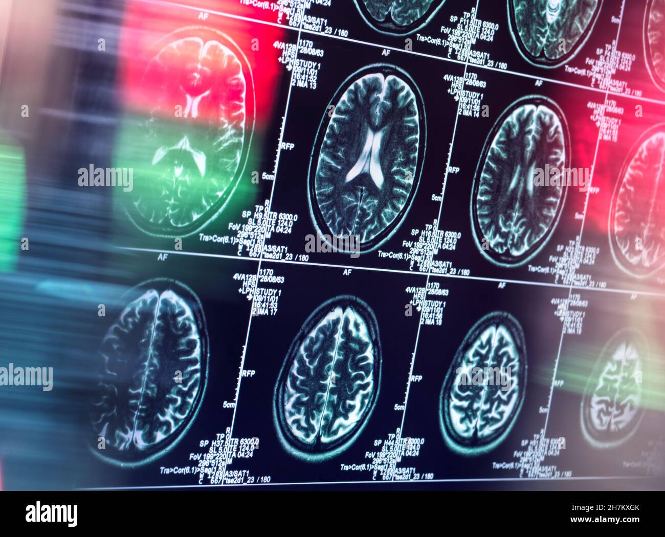 Untersuchung des menschlichen Gehirns in einer neurologischen Klinik Stockfoto
