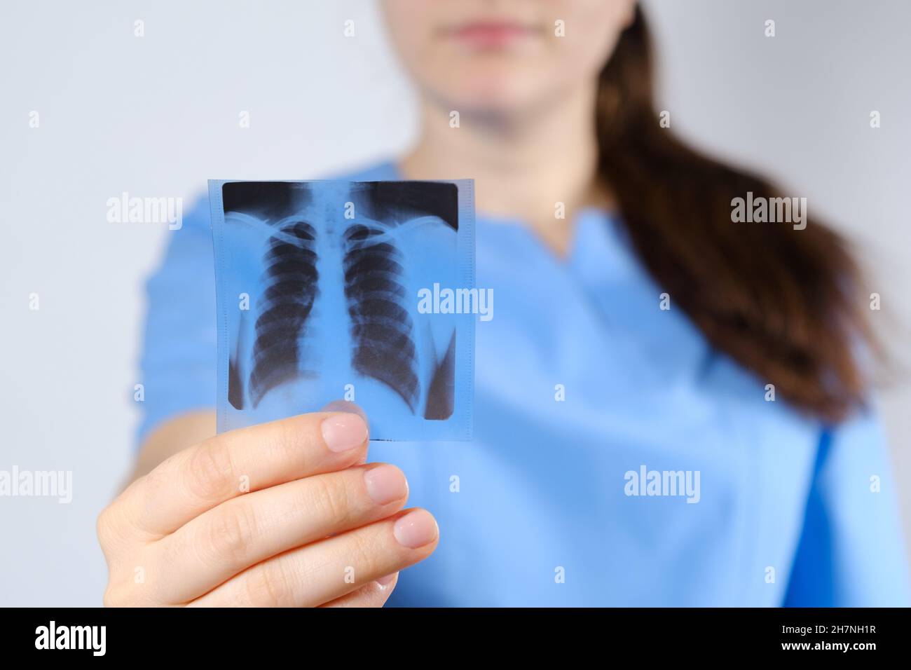 Ein Arzt in blauer Uniform zeigt ein Bild eines Fluorogramms der Fluorographie, eine Röntgenaufnahme der Lunge zur Prävention und Früherkennung Stockfoto