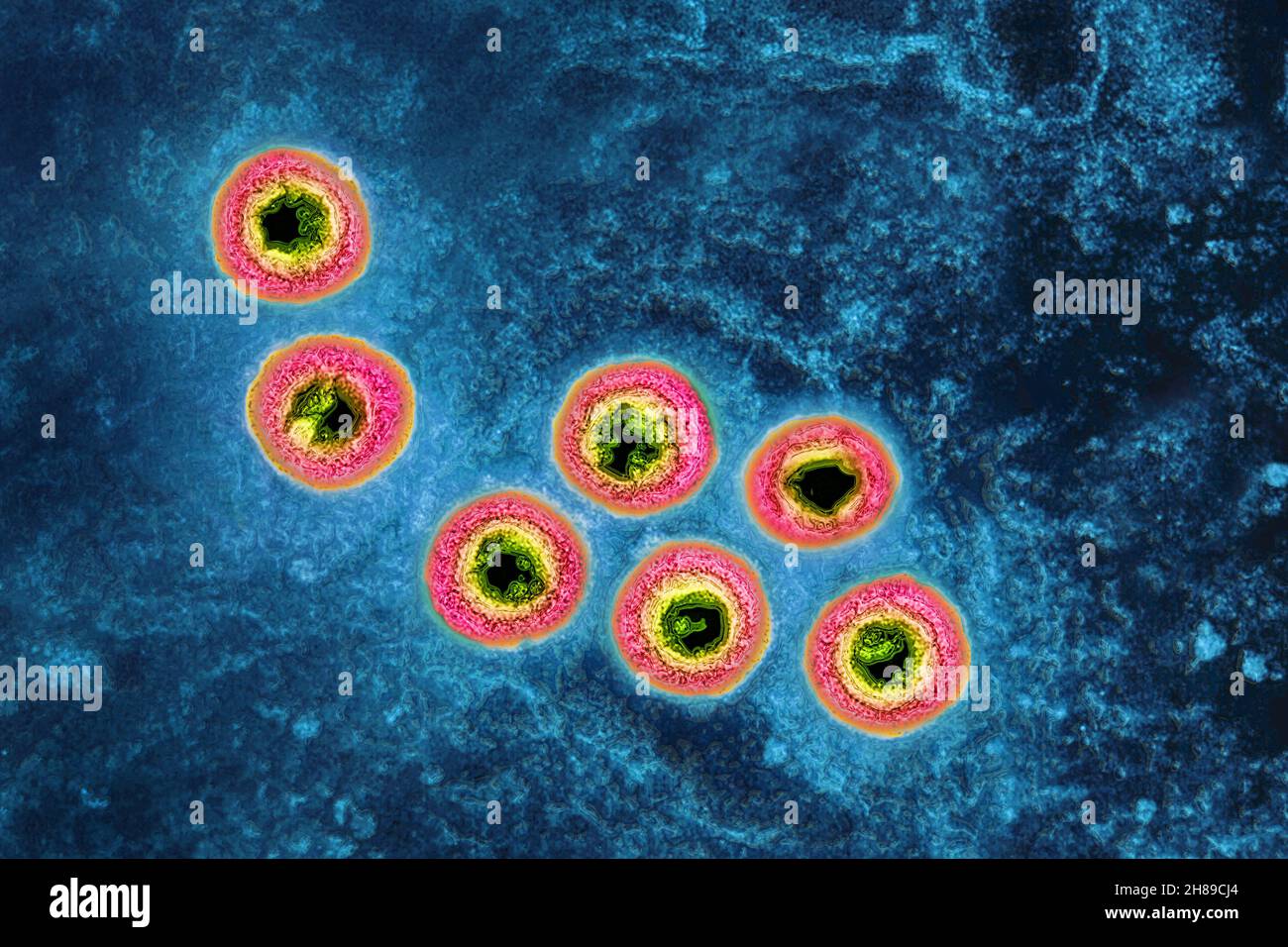 Herpesviridae chickenpox Fotos und Bildmaterial in hoher Auflösung