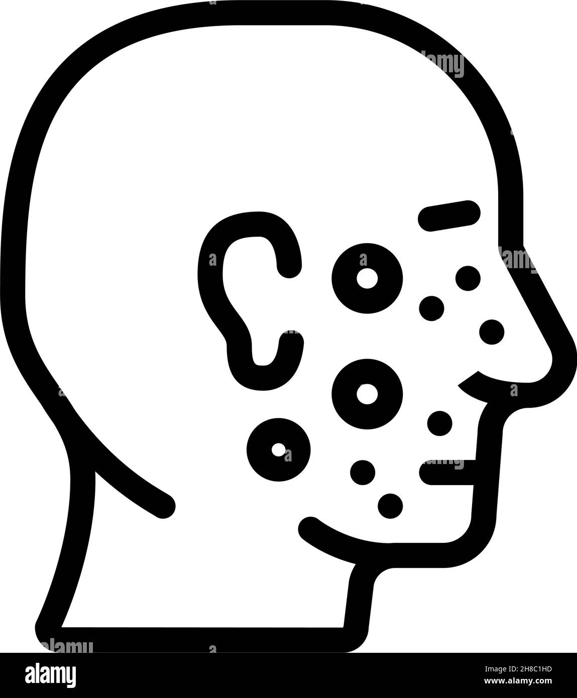 Akne Gesichtshaut Krankheit Linie Symbol Vektor Illustration Stock Vektor