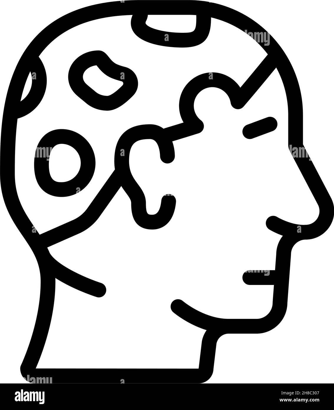 Alopecia areata Linie Symbol Vektor Illustration Stock Vektor