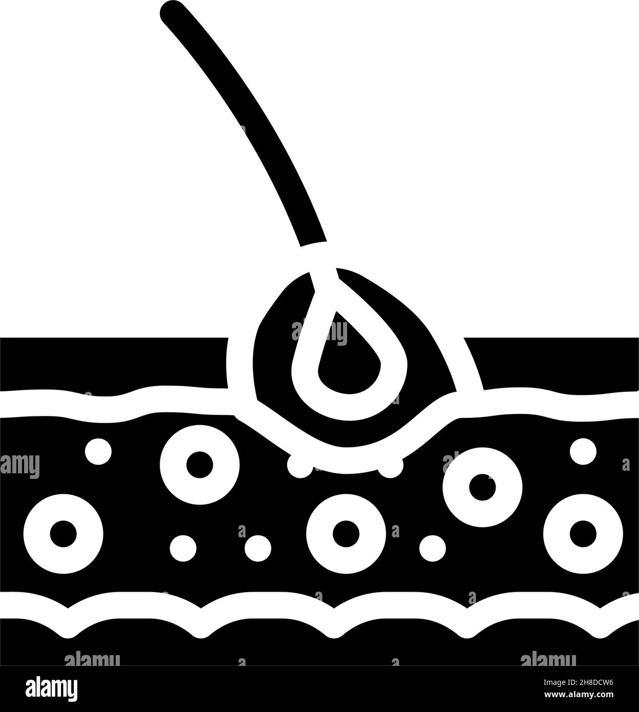 Follikulitis Hauterkrankung Problem Glyphe Symbol Vektor Illustration Stock Vektor