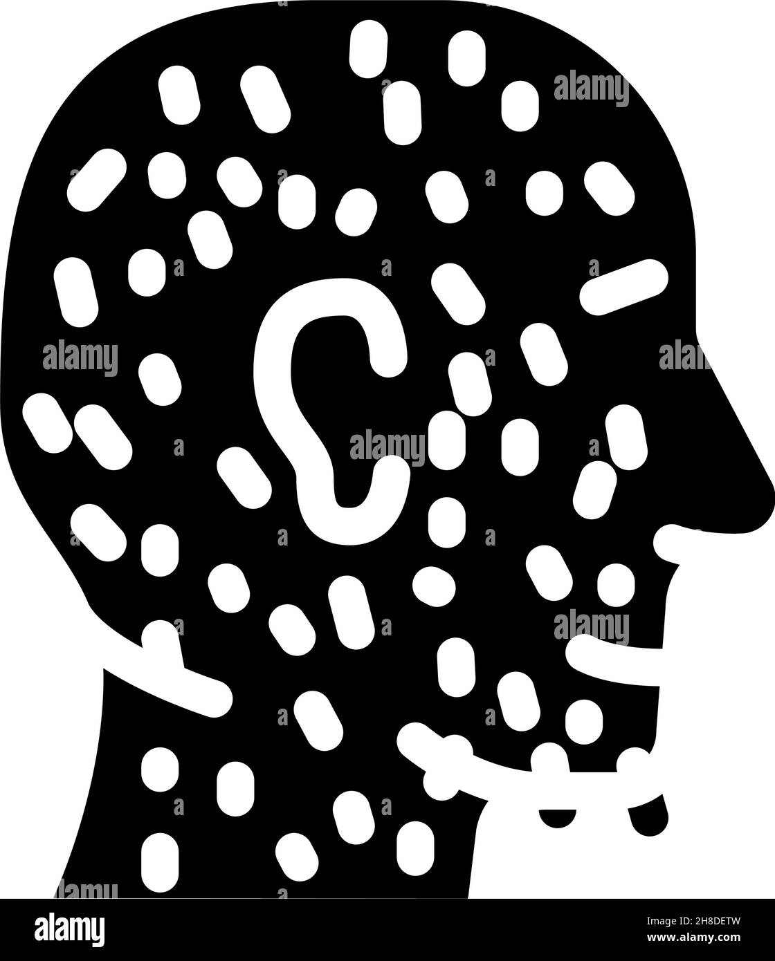 Hypertrichose Hautkrankheit Glyphen Symbol Vektor Illustration Stock Vektor